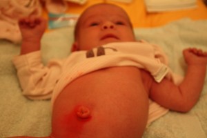 NombrilUMi. Le nombril de Mathilde